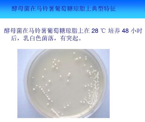 PPT圖解丨常見(jiàn)微生物菌落形態(tài)與微生物菌劑